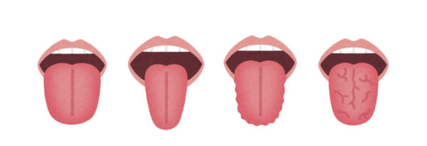 舌の形を説明するイラスト